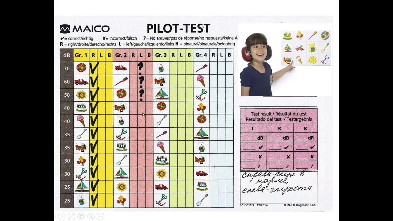 Слуховой анализатор 2