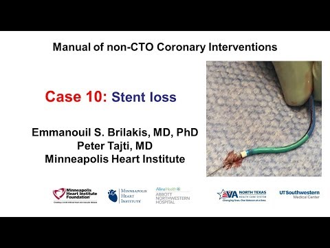Case 10: PCI Manual - Stent loss