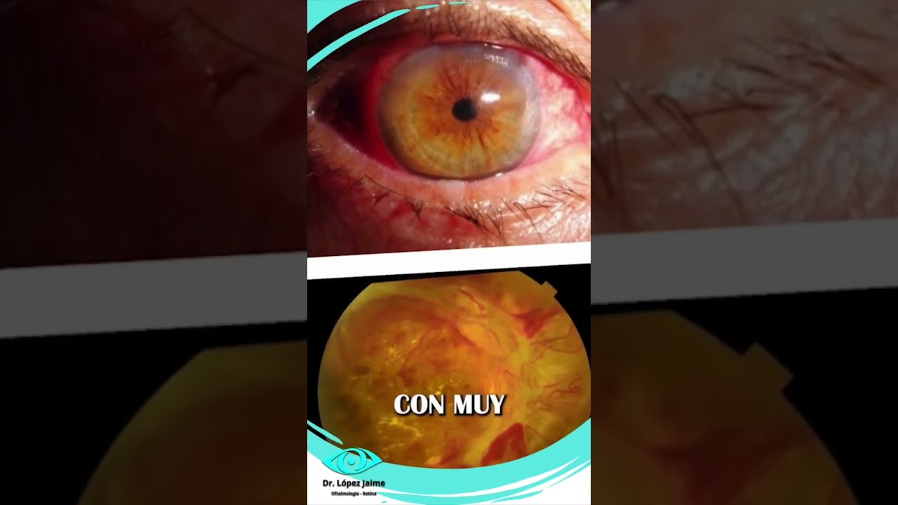 Gilberto Raúl López Jaime-20