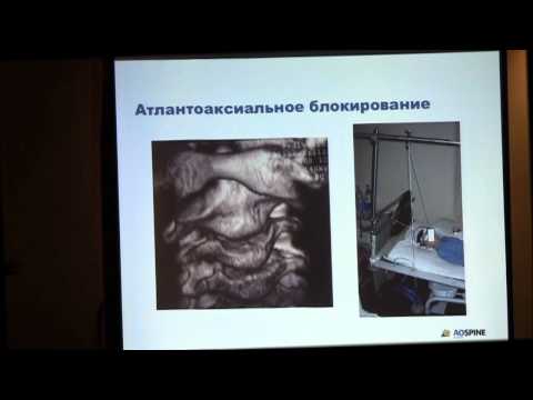 Средство от болей в позвоночнике и суставах Боль в суставах и температура 37.2 у