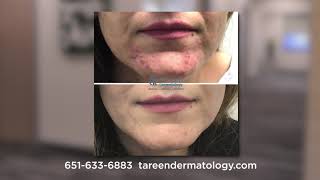 Tareen Dermatology - Top Dermatologists in Minnesota