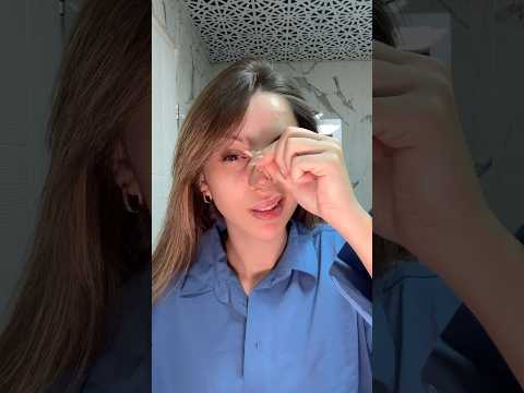 Yeni burnuma merhaba diyiniz #merveeben