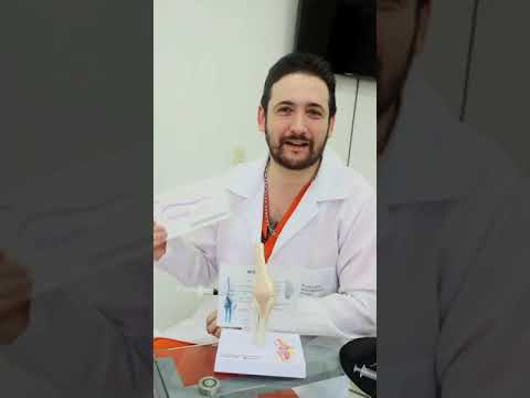 Infiltración con ácido hialurónico para la artrosis -  Dr. Andrés de la Espriella Barranquilla