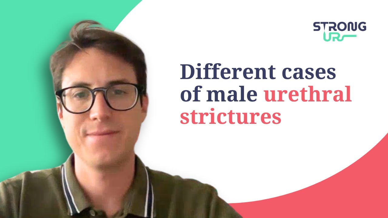 Different cases of male urethral strictures