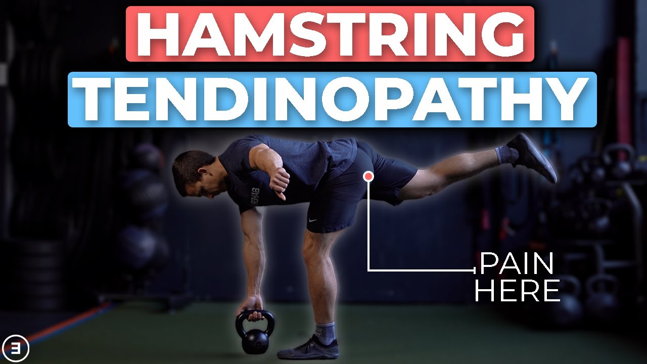 Proximal Hamstring Tendinopathy Rehab (4 Stages)