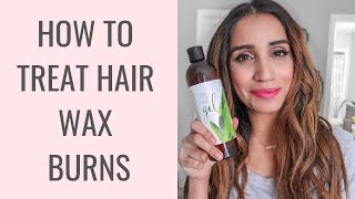 How to Treat Hair Wax Burns