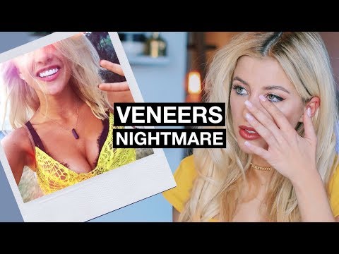 download lagu mp3 mp4 Failed Veneers, download lagu Failed Veneers gratis, unduh video klip Failed Veneers