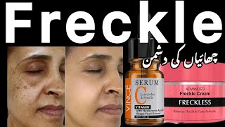 Vince's MIRACULOUS Freckle Cream Solution?