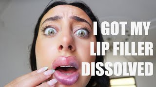 I GOT ALL MY LIP FILLER DISSOLVED... (omg im so ugly now)