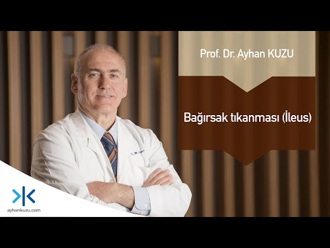 Bağırsak Tıkanması İleus