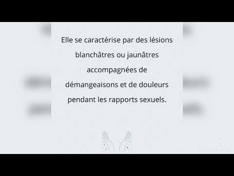 Le lichen scléreux vulvaire : une souffrance silencieuse