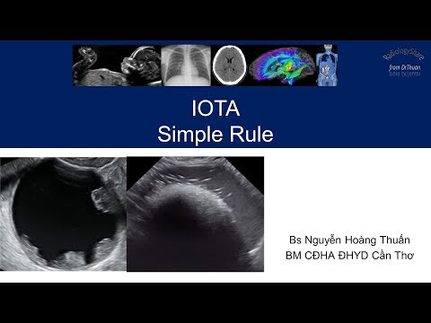 Regra Simples IOTA
