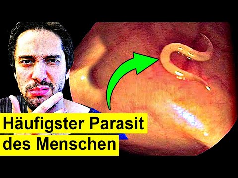 1,5 Milliarden Menschen haben diesen Parasit - Du auch?