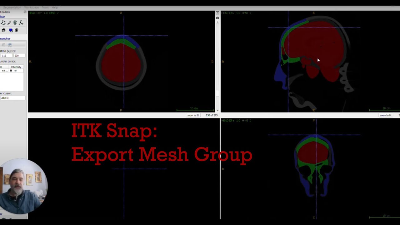 Export Surface Mesh Group from ITK SNAP
