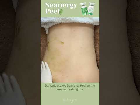 Chemical Peel