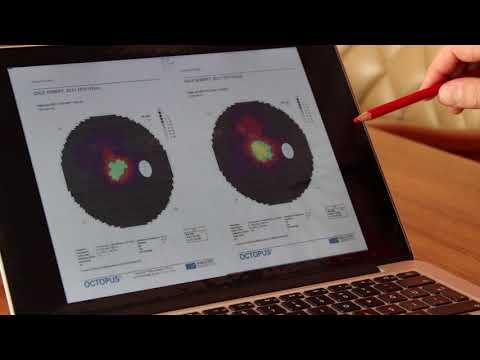 Retinitis Pigmentosa Treatment - November 2017-new patient results - FIRATLI CLINIC