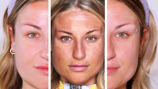 CÓMO ELIMINÉ EL 90% DE MIS MANCHAS con solo 2 PRODUCTOS | Vídeo REAL 🚫 NO PUBLI 🚫 Mi experiencia