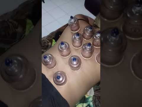 Tratamento com Ventosa 