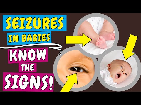 Seizures in Babies: Signs, Causes and what to do when your Baby has a Seizure