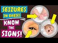 Seizures In Babies Signs Causes And What To Do When Your Baby Has A Seizure