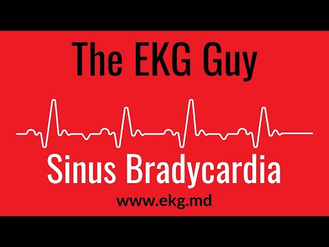 Sinus Bradycardia EKG l The EKG Guy - www.ekg.md
