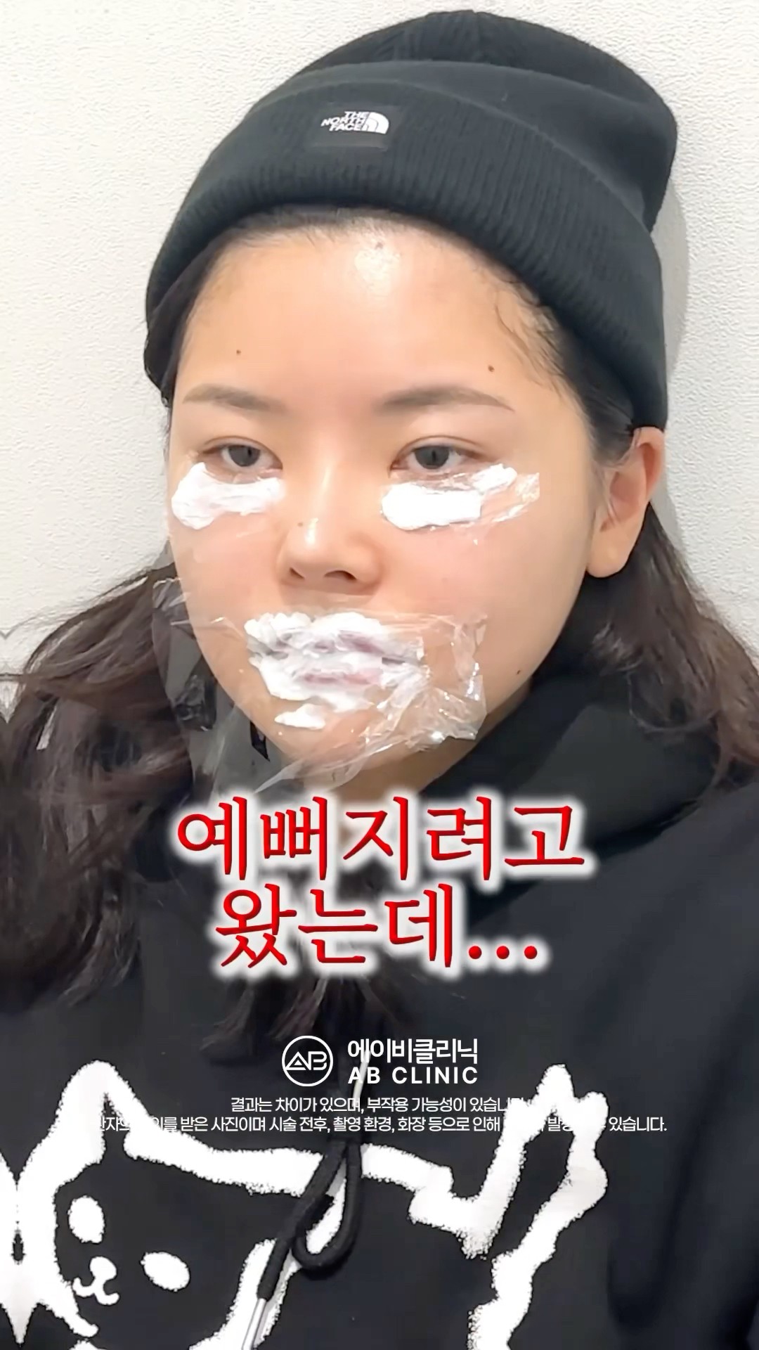 밋밋한 얼굴 필러로 변신하기💉