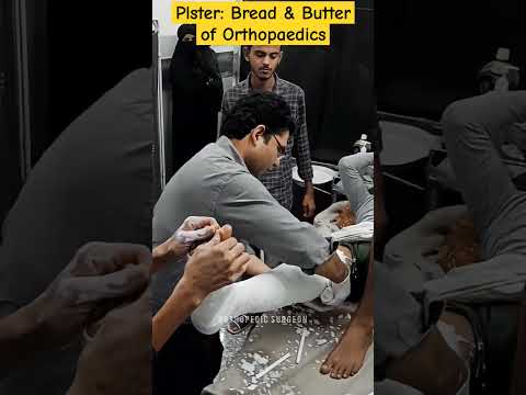 Plaster for Fracture #shorts #viral #trending #doctor #viral #fracture #plaster #reels #india #bone