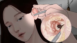 고막까지 시원하게 보이는 귀청소 with 수전증 친구 / 귀 내시경 ASMR 애니메이션