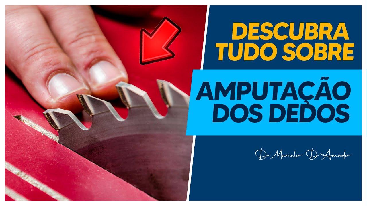 LESÃO NO DEDO | DESCUBRA TUDO SOBRE AMPUTAÇÃO DOS DEDOS E SUAS COMPLICAÇÕES!
