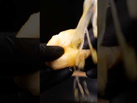 Exploding Butter Potato Balls 💥