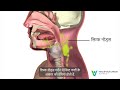 Hindi What Is Oral Or Mouth Cancer Signs Symptoms Head And Neck Cancer