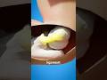 Tommy John Surgery Surgeon Reacts