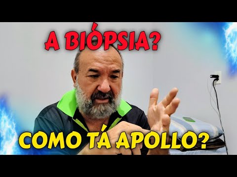 A BIÓPSIA? COMO TÁ APOLLO? / M 16/ C 25/ 2026