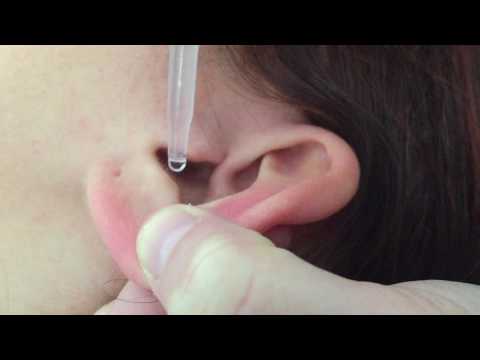 How to Use Ear Drops