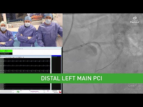Distal left main PCI - Webinar