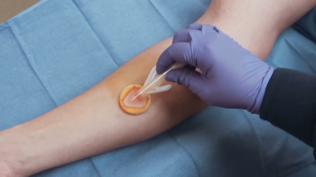 BD ChloraPrep™ In-Service Video - 1mL, 3 mL, & FREPP