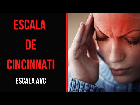 Cincinnati Stroke Scale: Stroke Assessment