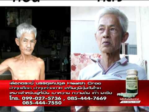 โรคสะเก็ดเงิน Palmar-plantar วิธีที่จะอยู่ ฉันหายจากโรคเรื้อนกวาง