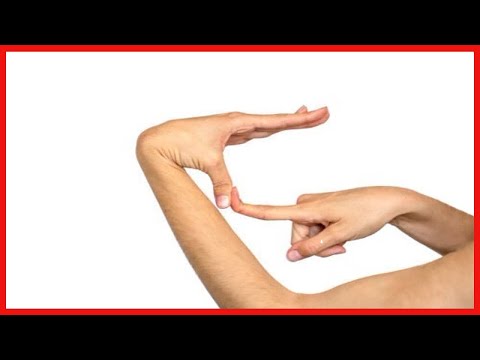 Ehlers-Danlos-Syndrom (EDS): Was ist das?