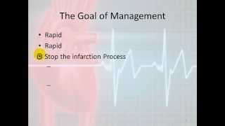 12 Lead Interpretation Part 7: Management of MI
