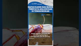 Kakek Ini Risih karena Napas Bau Busuk Selama 3 Hari, Ternyata Ada Kecoak Nyangkut di Tenggorokan