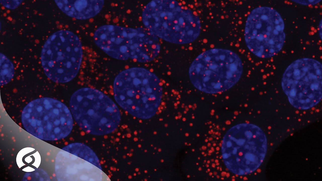 A new approach for triple-negative breast cancer #science #cancer