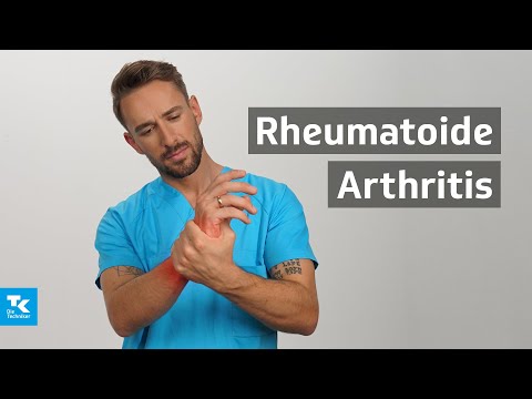 Rheumatoide Arthritis (Rheuma) verstehen: Ursachen, Symptome, Diagnose & Therapie | DocTommy