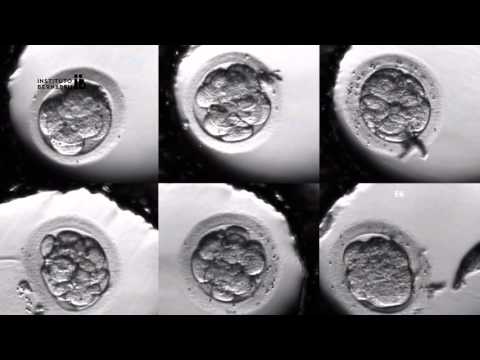 IVF PROCESS STEP BY STEP (In Vitro Fertilisation): Embryo cultivation