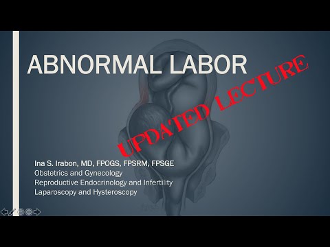 Abnormal labor (updated lecture)
