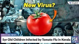 5yr Old Children Infected by Tomato Flu in Kerala