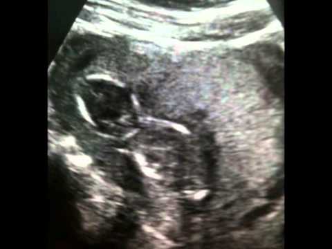 Sternenkind Conner Marcel