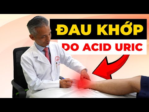 Đau Xương Khớp Do Acid Uric Tăng Cao - Nguy Hiểm Khôn Lường!