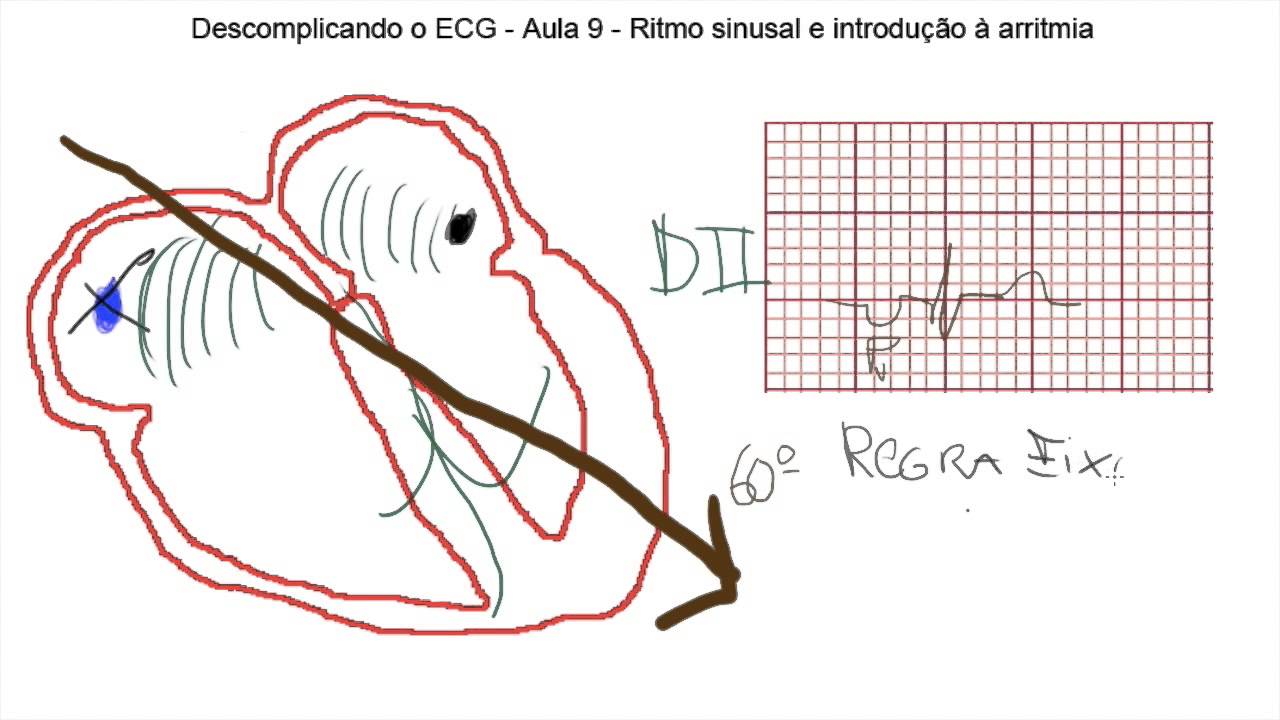 Descomplicando o ECG   Aula 9 - Ritmo sinusal e introdução a arritmias