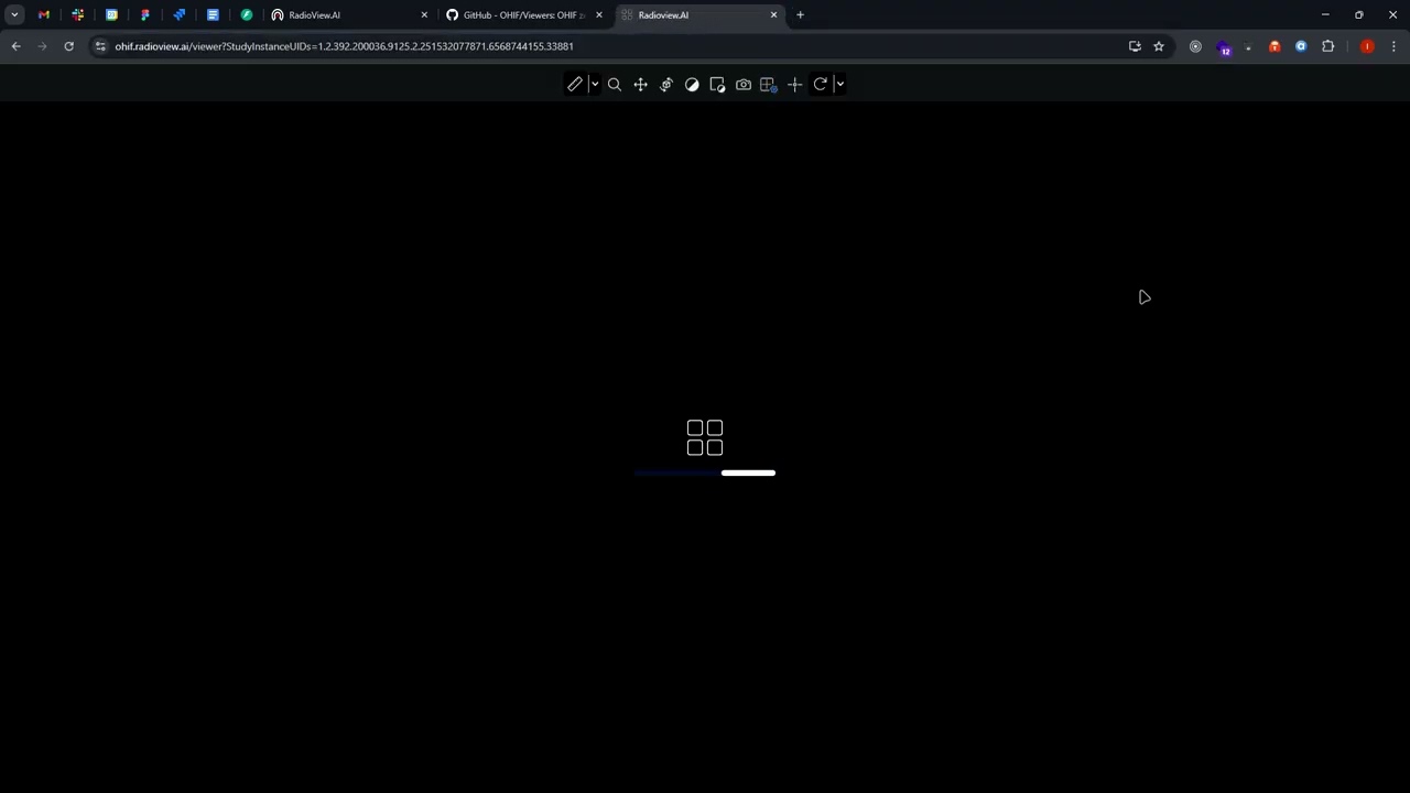 Using OHIF DICOM viewer as an Iframe component inside of another web application.